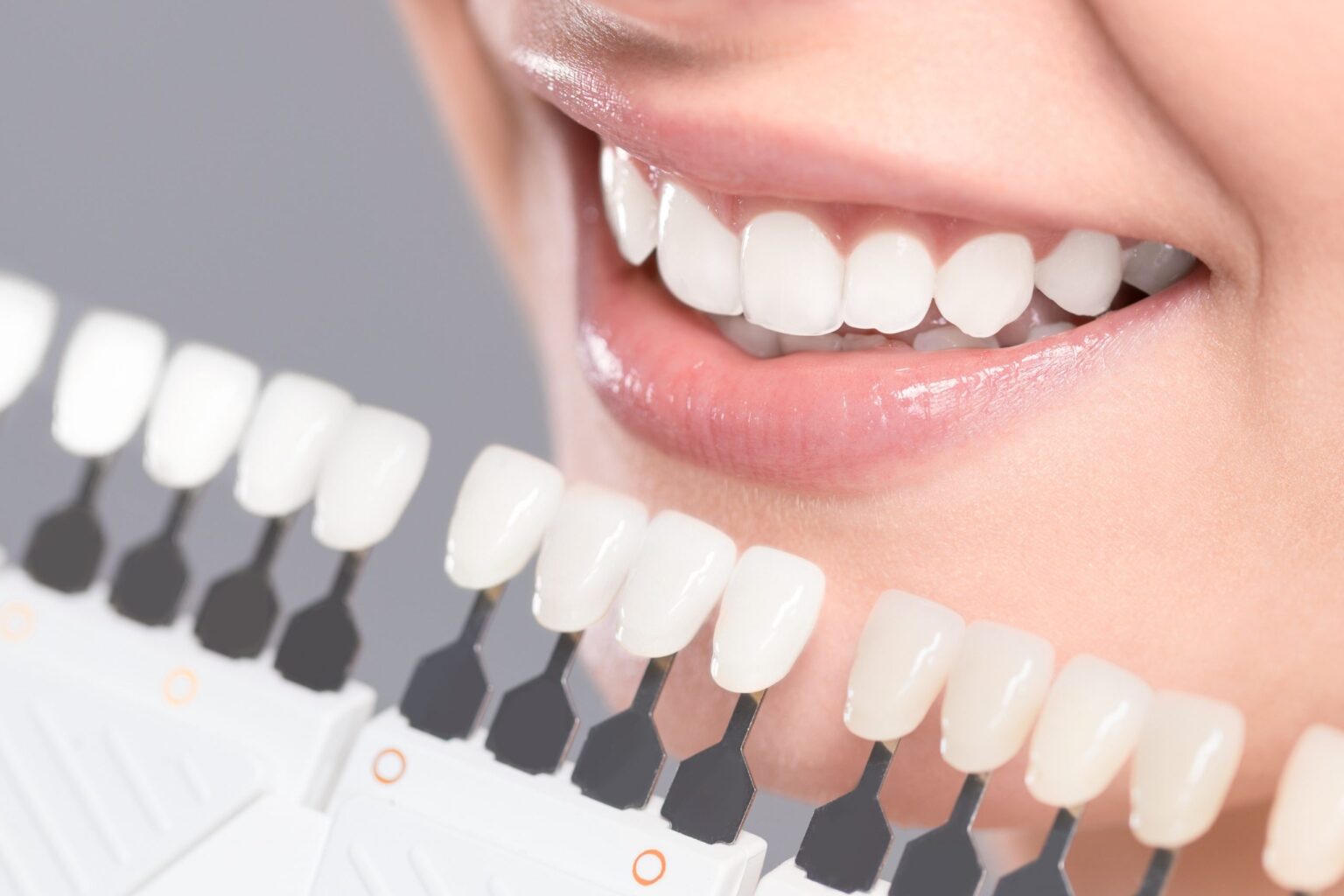 Consejos para aliviar la sensibilidad dental después del blanqueamiento